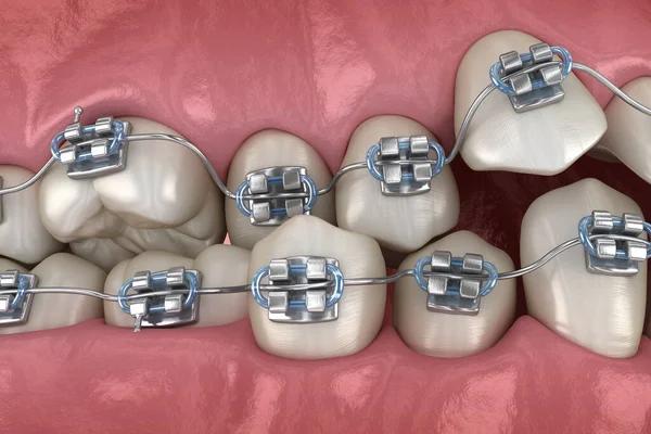 Transform Your Smile and Boost Your Confidence